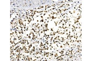 IHC analysis of JUNB using anti-JUNB antibody (ABIN7603223). (JunB 抗体  (N-Term))