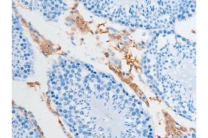 ABIN6267252 at 1/100 staining rat testicular tissue sections by IHC-P. (CHEK2 抗体  (pSer516))