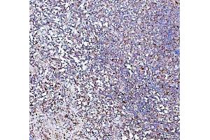 IHC analysis of PPA2 using anti-PPA2 antibody (ABIN6719431). (PPA2 抗体  (AA 33-334))