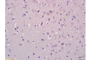 Formalin-fixed and paraffin embedded rat brain tissue labeled with Anti-ATX2 Polyclonal Antibody, Unconjugated (ABIN872411) at 1:200, followed by conjugation to the secondary antibody and DAB staining