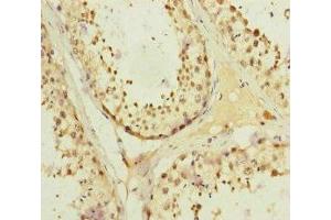 Immunohistochemistry of paraffin-embedded human testis tissue using ABIN7157660 at dilution of 1:100 (KIFC3 抗体  (AA 140-390))