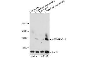 Western blot analysis of extracts of HeLa and C2C12 cells, using Phospho-STMN1-S16 antibody (ABIN2987668) at 1/2000 dilution. (Stathmin 1 抗体  (pSer16))