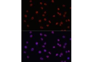 Immunofluorescence analysis of C6 cells using MYCT1 antibody (ABIN7268717) at dilution of 1:100. (Myc Target 1 抗体  (AA 99-235))