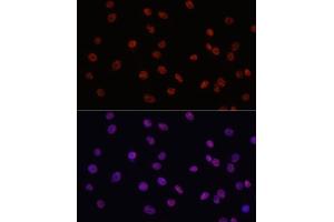 Immunofluorescence analysis of C6 cells using MYCT1 antibody (ABIN7268717) at dilution of 1:100.
