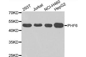 Western blot analysis of extracts of various cell lines, using PHF6 antibody. (PHF6 抗体)