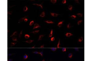 Immunofluorescence analysis of L929 cells using MAP2K7 Polyclonal Antibody at dilution of 1:100. (MAP2K7 抗体)