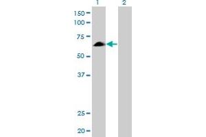 Western Blot analysis of EYA2 expression in transfected 293T cell line by EYA2 monoclonal antibody (M04), clone 2F8. (EYA2 抗体  (AA 164-271))