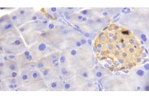 Detection of HBb in Mouse Pancreas Tissue using Polyclonal Antibody to Hemoglobin Beta (HBb) (Hemoglobin Subunit beta 抗体  (AA 1-147))