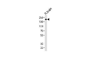 Western blot analysis of lysate from rat brain tissue, using Mouse Insrr Antibody (C-term) (ABIN6243236 and ABIN6577628).