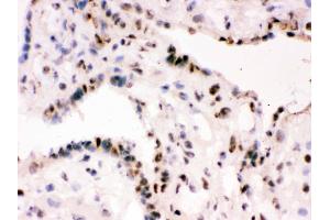 IHC analysis of RbAp48 using anti-RbAp48 antibody . (Retinoblastoma Binding Protein 4 抗体  (C-Term))
