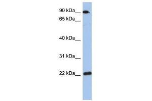 TMED10 antibody used at 1 ug/ml to detect target protein. (TMED10 抗体)