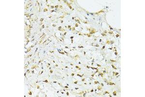 Immunohistochemistry of paraffin-embedded human vermiform appendix using TRIM15 antibody (ABIN5999102) at dilution of 1/100 (40x lens). (TRIM15 抗体)