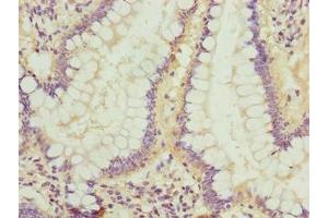 Immunohistochemistry of paraffin-embedded human small intestine tissue using ABIN7158182 at dilution of 1:100 (LRRC42 抗体  (AA 201-428))