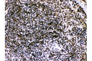 Immunohistochemistry (Paraffin-embedded Sections) (IHC (p)) image for anti-BCL2-Interacting Killer (Apoptosis-Inducing) (BIK) (AA 1-123) antibody (ABIN3043509) (BIK 抗体  (AA 1-123))