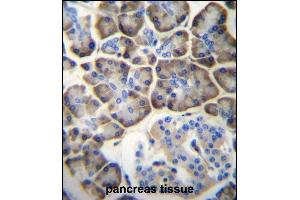 Immunohistochemistry (Paraffin-embedded Sections) (IHC (p)) image for anti-Potassium Channel, Subfamily V, Member 2 (KCNV2) (AA 478-507), (C-Term) antibody (ABIN657006)