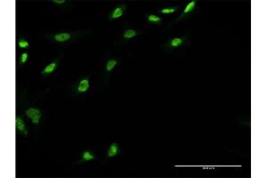 Immunofluorescence of monoclonal antibody to UBE2E3 on HeLa cell. (UBE2E3 抗体  (AA 65-152))