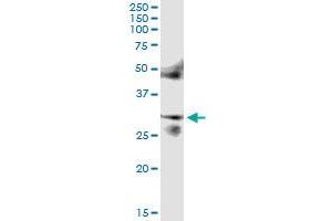 Immunoprecipitation of FOSL2 transfected lysate using anti-FOSL2 MaxPab rabbit polyclonal antibody and Protein A Magnetic Bead , and immunoblotted with FOSL2 purified MaxPab mouse polyclonal antibody (B01P) . (FOSL2 抗体  (AA 1-326))