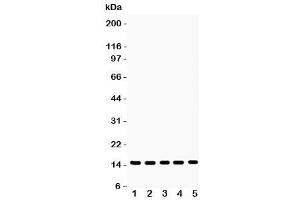 Western blot testing of Profilin-1 antibody and Lane 1:  rat testis (PFN1 抗体  (C-Term))