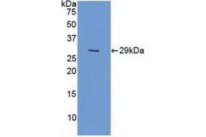 ERCC5 antibody  (AA 778-986)