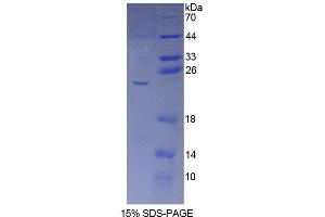SDS-PAGE analysis of Human CYP5A1 Protein. (TBXAS1 蛋白)