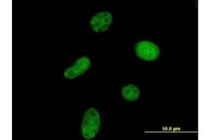 Immunofluorescence of purified MaxPab antibody to UCKL1 on HeLa cell. (UCKL1 抗体  (AA 1-419))