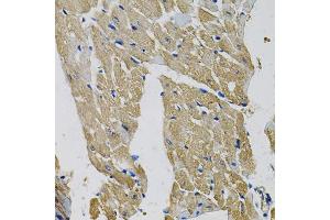 Immunohistochemistry of paraffin-embedded mouse heart using EIF3H Antibody. (EIF3H 抗体)