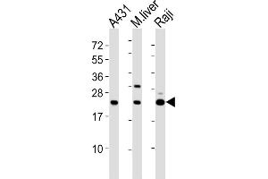 All lanes : Anti-PSMB9 Antibody (C-term) at 1:2000 dilution Lane 1: A431 whole cell lysates Lane 2: mouse liver lysates Lane 3: Raji whole cell lysates Lysates/proteins at 20 μg per lane. (PSMB9 抗体  (C-Term))