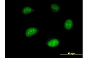 Immunofluorescence of monoclonal antibody to ISG20 on HeLa cell. (ISG20 抗体  (AA 1-181))