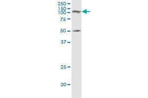 SAGE1 monoclonal antibody (M02), clone 5C1. (SAGE1 抗体  (AA 357-455))