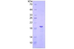 SDS-PAGE analysis of Human LPCAT3 Protein. (LPCAT3 蛋白)