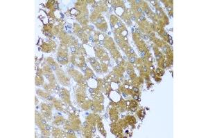 Immunohistochemistry of paraffin-embedded human liver injury using STRN antibody. (Striatin 抗体  (AA 581-780))