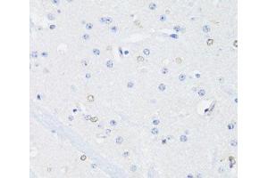Immunohistochemistry of paraffin-embedded Mouse brain using SS18L1 Polyclonal Antibody at dilution of 1:100 (40x lens). (SS18L1 抗体)