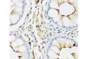 Immunohistochemistry of paraffin-embedded Human colon using RNASE3 Polyclonal Antibody at dilution of 1:100 (40x lens). (RNASE3 抗体)
