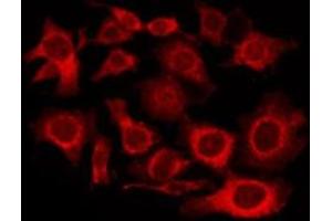 ABIN6276000 staining Hela by IF/ICC. (GPR101 抗体  (Internal Region))