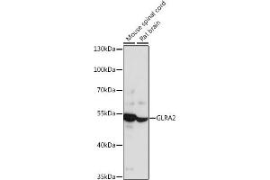 Western blot analysis of extracts of various cell lines, using GLR antibody (ABIN7267462) at 1:1000 dilution. (GLRa2 抗体  (AA 350-420))