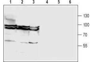 Western blot analysis of rat brain (lanes 1 and 4), mouse brain (lanes 2 and 5) and human U87-MG glioma cell (lanes 3 and 6) lysates: - 1-3.