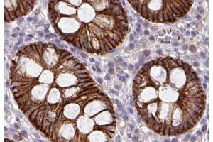 Catenin-γ Antibody for IHC in human colon tissue.