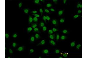 Immunofluorescence of monoclonal antibody to GATA2 on HeLa cell. (GATA2 抗体  (AA 1-102))