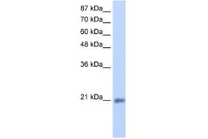 MIF4GD antibody used at 1. (MIF4GD 抗体  (C-Term))