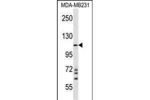 NLRC4 Antibody (N-term) (ABIN657230 and ABIN2846332) western blot analysis in MDA-M cell line lysates (35 μg/lane). (NLRC4 抗体  (N-Term))