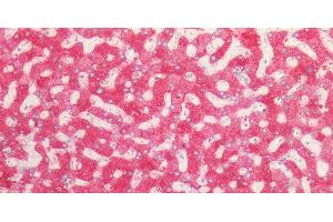 Immunohistochemistry of paraffin-embedded Human liver using PCK1 Polyclonal Antibody at dilution of 1:100. (PCK1 抗体)