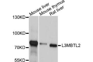 Western blot analysis of extracts of various cell lines, using L3MBTL2 antibody (ABIN5998104) at 1/1000 dilution. (L3MBTL2 抗体)