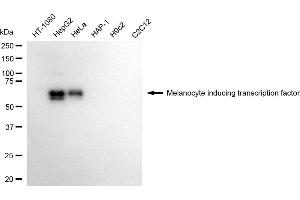 Western blotting analysis using Melanocyte inducing transcription factor antibody (ABIN7799406).