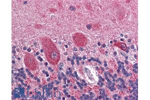 Immunohistochemistry (IHC) image for anti-Glutamate Decarboxylase 2 (Pancreatic Islets and Brain, 65kDa) (GAD2) (Internal Region) antibody (ABIN185388)