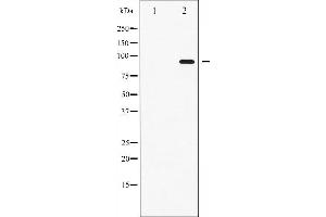Western Blotting (WB) image for anti-Signal Transducer and Activator of Transcription 6, Interleukin-4 Induced (STAT6) (pThr645) antibody (ABIN6255720)