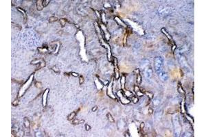 Immunohistochemistry (IHC) image for anti-VEGF Receptor 2 (VEGFR2) (AA 20-244) antibody (ABIN5708186)