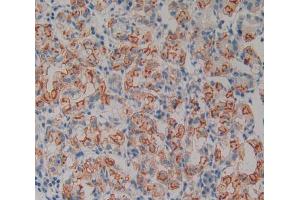 Used in DAB staining on fromalin fixed paraffin- embedded stomach tissue (Neurotrophin 4 抗体  (AA 81-210))