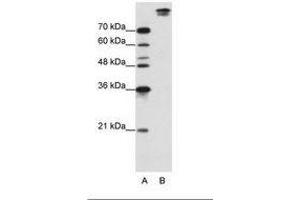 Image no. 1 for anti-Pre-mRNA Branch Site Protein p14 (SF3B14) (AA 131-180) antibody (ABIN203254) (Pre-mRNA Branch Site Protein p14 (SF3B14) (AA 131-180) 抗体)