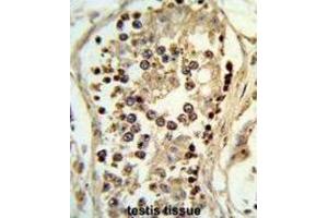 Immunohistochemistry (IHC) image for anti-Abhydrolase Domain Containing 12 (ABHD12) antibody (ABIN3003955) (ABHD12 抗体)