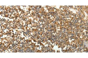 Immunohistochemistry of paraffin-embedded Human tonsil tissue using SFTPD Polyclonal Antibody at dilution 1:30 (SFTPD 抗体)